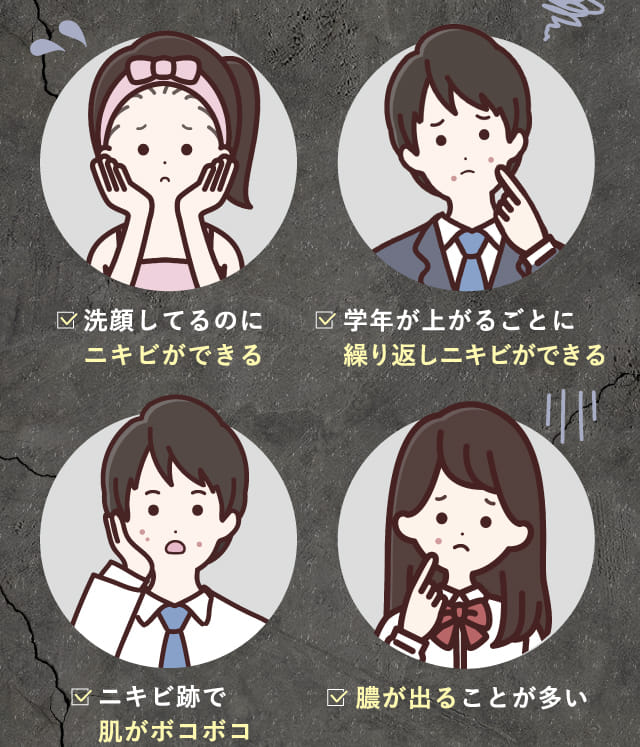 洗顔してるのにニキビができる 学年が上がるごとに繰り返しニキビができる ニキビ跡で肌がボコボコ 膿が出ることが多い